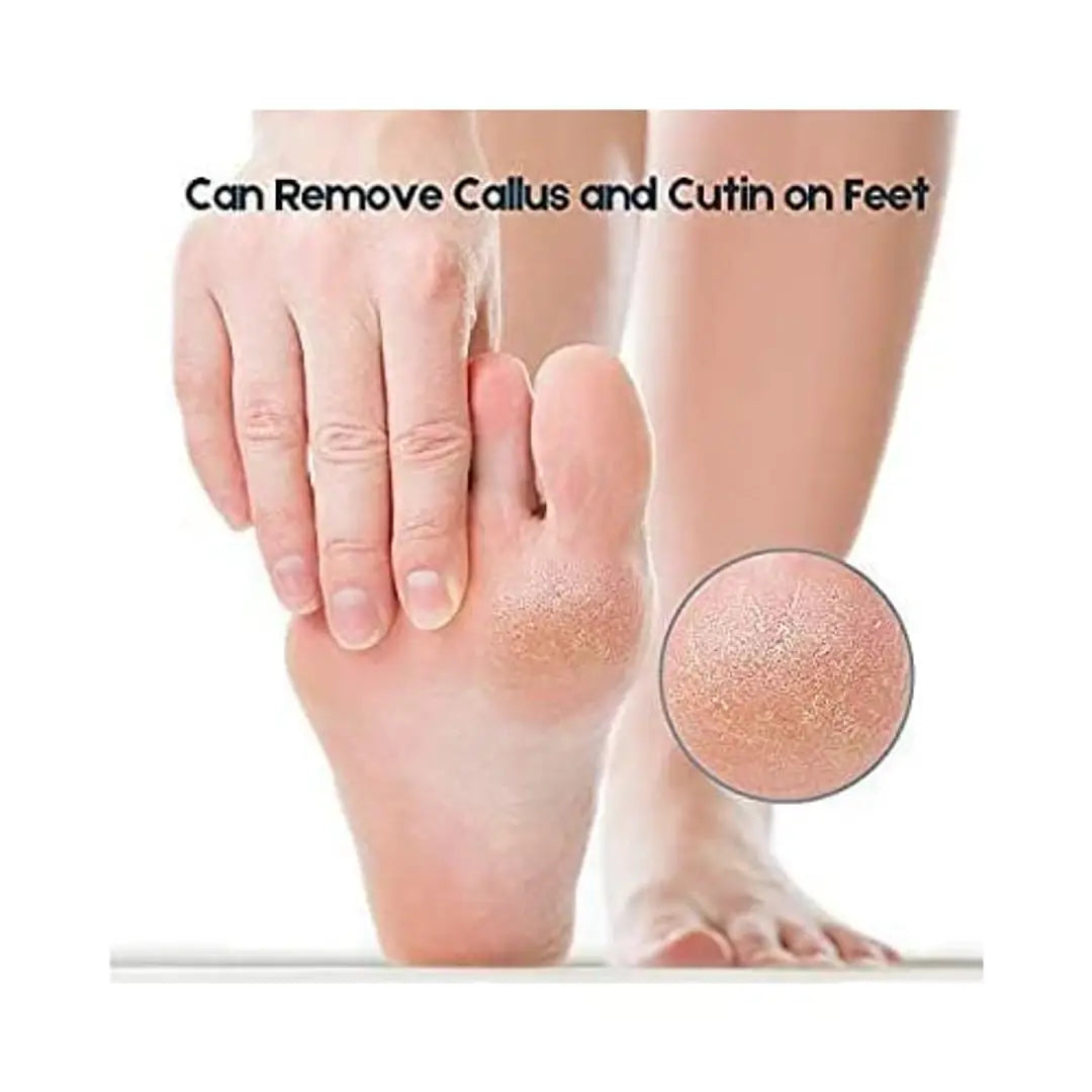 Topinon Lava Pumice Stone for Foot Callus Knees and Elbow|Premium Quality Pedicure- Callus Remover for Feet & Hands - Pedicure Tool Exfoliation to remove dead skin - 2 Pcs